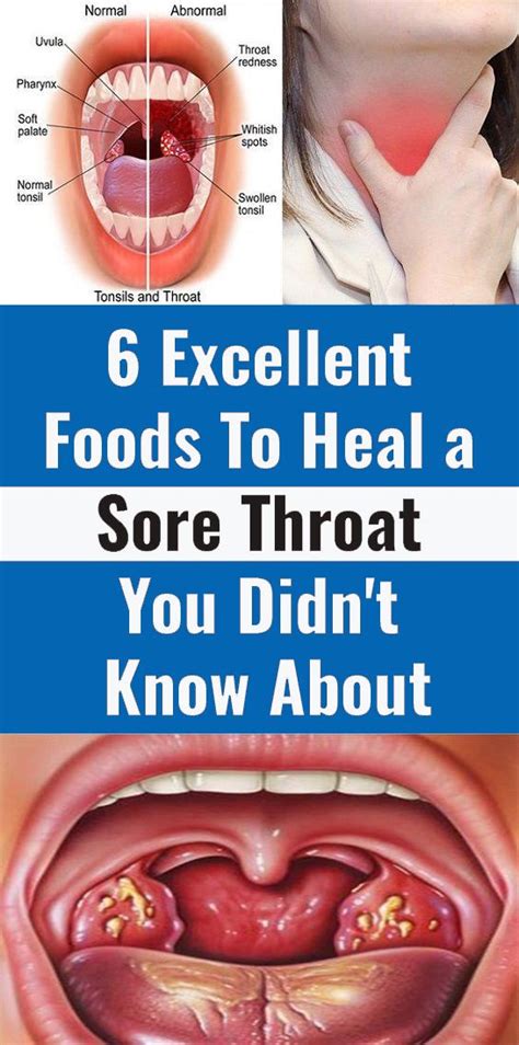 6 Excellent Foods To Heal A Sore Throat You Didnt Know About Heal