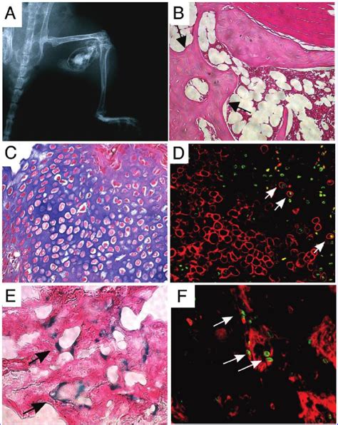 Ectopic Bone Formation Weeks After Implantation Of Muadas Lacz Bmp Download Scientific
