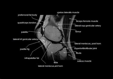 General anatomy and musculoskeletal system. mri knee anatomy | knee sagittal anatomy | free cross ...