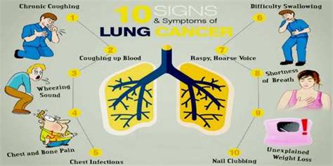 Discover 10 common lung cancer symptoms at 10faq health and stay better informed to make the diagnosis of lung cancer is confirmed through biopsy by bronchoscopy. About Lung Cancer - Assignment Point