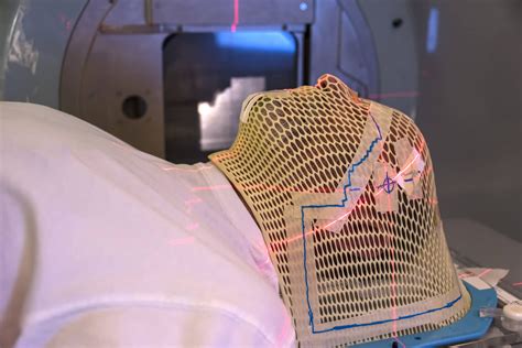 Proton Therapy A Treatment For Tumours Open Medscience