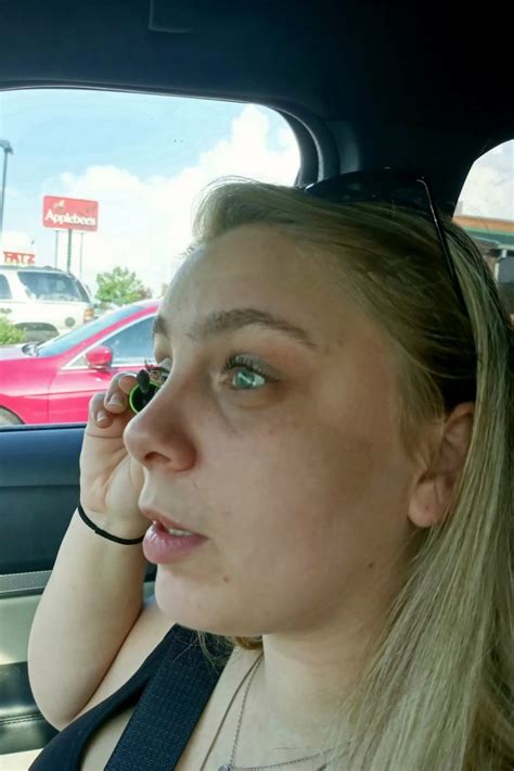 Woman Who Ripped Her Own Eyes Out While On Meth Gets Prosthetics