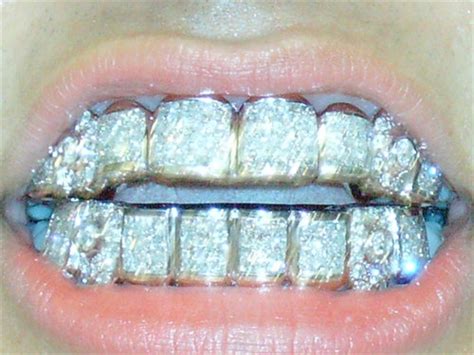 Gives New Meaning To The Term Sparkling Smile Odds Bodkins