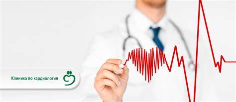 Кардиология диета 10 Клиника по Кардиология и инвазивна кардиология - Болница "Софиямед" Клиника по Кардиология и инвазивна кардиология - Болница "Софиямед" Кардиология диета 10