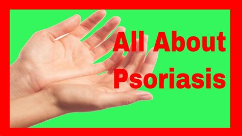 All About Psoriasis Diagnosis Causes Risk Factors Prevention