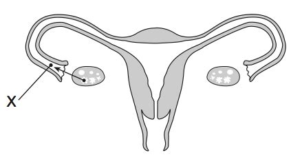 Ovaries also produce estrogen which maintains secondary sexual characteristics. Regents #2 - ProProfs Quiz