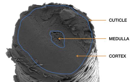 Medulla Human Hair Under Microscope Micropedia