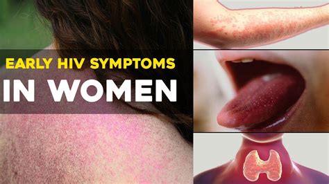 hiv symptoms in women early signs