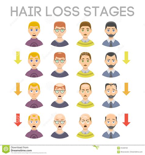 If you want to stop or reverse your. Information Chart Of Hair Loss Stages Types Of Baldness ...