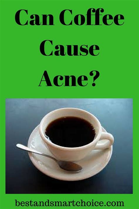 Your breath trapped beneath the mask makes the skin surface warm and moist. Can Coffee Cause Acne? Here's The Truth! #AcneTreatmentDIY ...