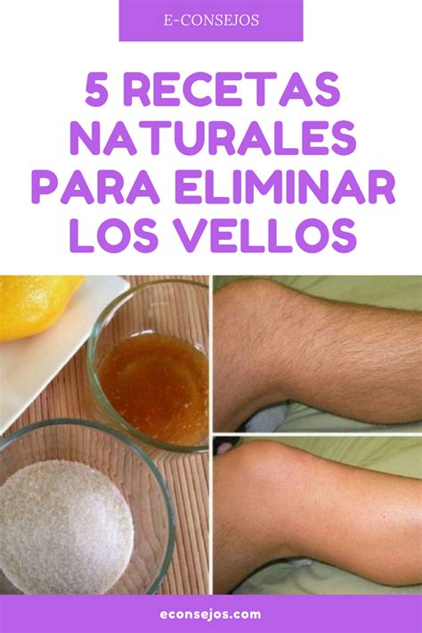 Las 5 Mejores Recetas Naturales Para Eliminar Los Vellos Eliminar El