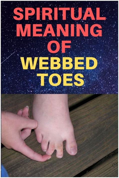 Syndactyly Webbed Toes Spiritual Meaning And Causes Spiritual