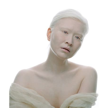 World S First Albino Model Talks Smashing Beauty Standards People Want You To Feel Different