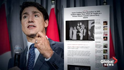 Trudeau Apologizes After 2001 Brownface Photo Published By Time