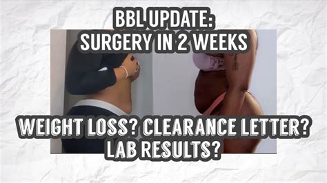 Bbl Update Surgery In 2 Weeks 😳 Weight Loss Clearance Letter
