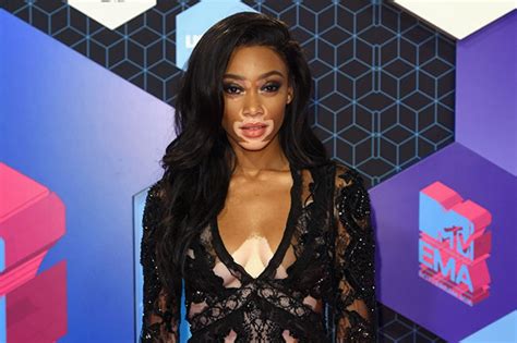 Mtv Ema 2016 è Winnie Harlow Modella Con La Vitiligine La Vera Star