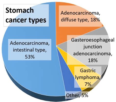Unraveling The Complexities Of Stomach Cancer An Extensive Examination