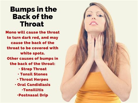 Bumps On Back Of Throat Common Causes And Natural Remedies