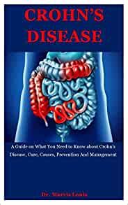 Crohn S Disease A Guide On What You Need To Know About Crohns Disease Cure Causes