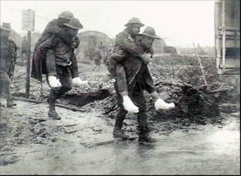 World One War Infamous Trench Foot Hubpages
