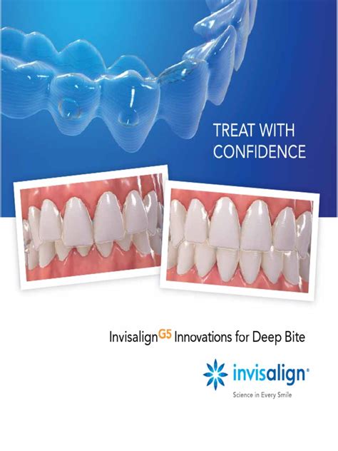 Invisalign G5 Brochure Pdf Dentistry Mouth