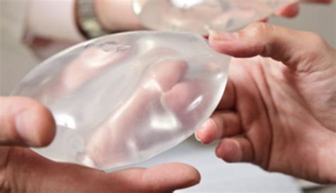 fda warns of rare cancer linked to breast implants wsvn 7news miami news weather sports