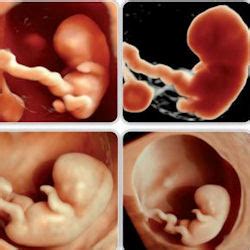 Un foetus évolue énormément, même lors du premier trimestre. image de 2 mois de grossesse