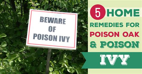 5 Home Remedies For Poison Oak And Poison Ivy Midwest Modern Momma