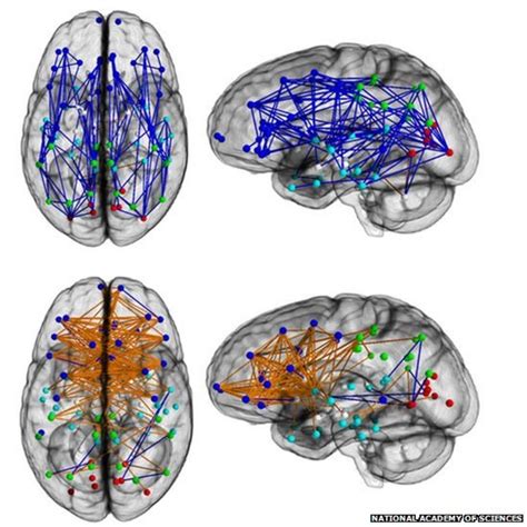 Men And Women S Brains Are Wired Differently Bbc News