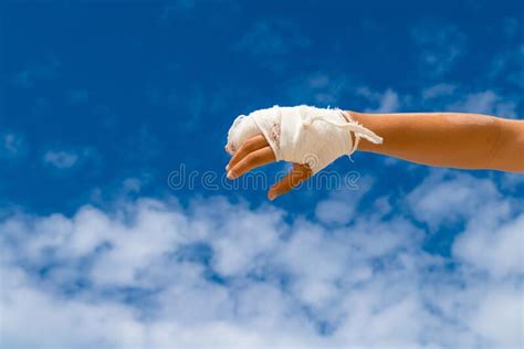 Broken Hand In White Cast On Blue Background With Copy Space For Text