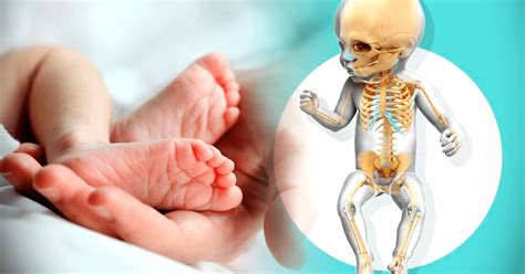 Cuantos Huesos Tiene Un Bebe Por Que Tienen Mas Huesos Que Los