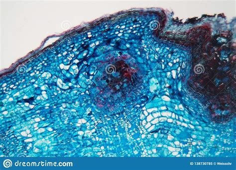 Maybe you would like to learn more about one of these? Difference Between Animal And Plant Cells Under Microscope ...