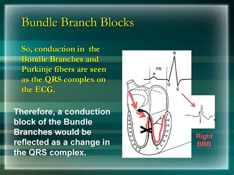 Basics Of Ecg презентация онлайн