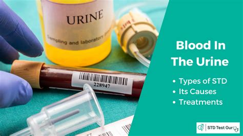 Std That Causes Blood In The Urine Causes Treatment And Testing Cost