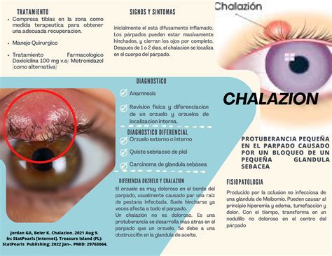 Chalazion Chalazion Fisiopatologia Compresa Tibias En La Zona