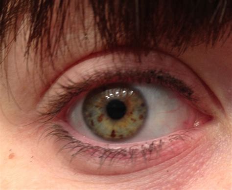 I Gots Eye Freckles Too Eyes