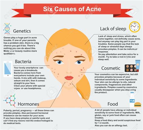 What Causes Acne 6 Surprising Reasons Your Face Breaks Out Acne Causes Acne Treatment Acne