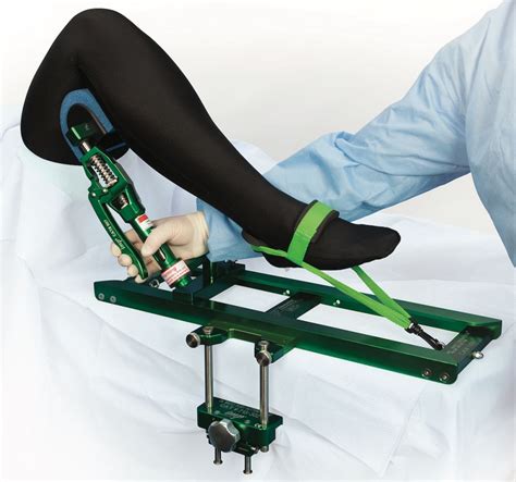 De Mayo Ankle Distractor® System Positions Patients Ankles Right Where