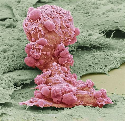 Mesenchymal Stem Cell Sem Photograph By Science Photo Library Pixels