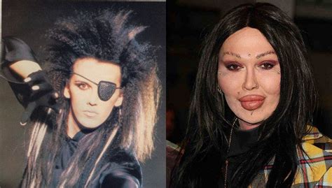 Pete Burns Most Shocking Celebrity Before And After Plastic Surgery