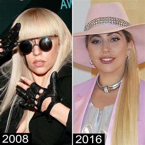 Lady Gaga Before And After Plastic Surgery Photos