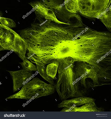 Real Fluorescence Microscopic View Human Skin Stock Photo 465565274