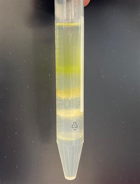 How To Extract Layers From Percoll Gradient Isolation Researchgate