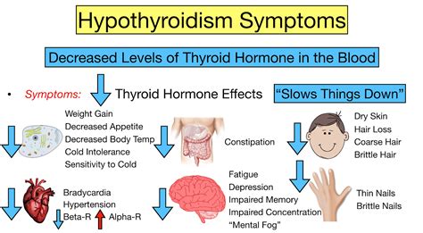 Hypothyroidism Symptoms