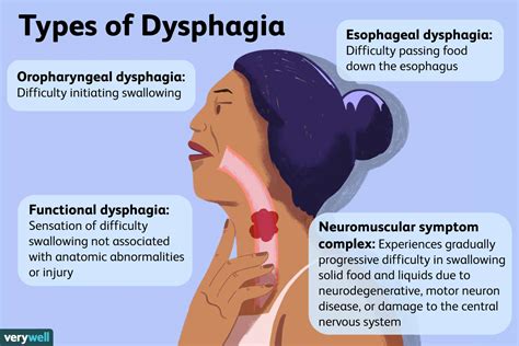 Dysphagia And Mental Illness Causes And Symptoms