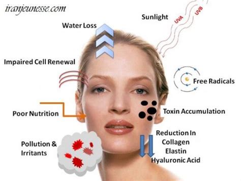 Causes Of Aging Skin 1 ایران ژنس
