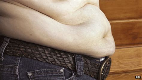 Doctors Unite To Combat Obesity Bbc News
