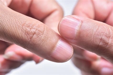 Heres What It Means If You Have Ridges On Your Nails Pulse Daily News