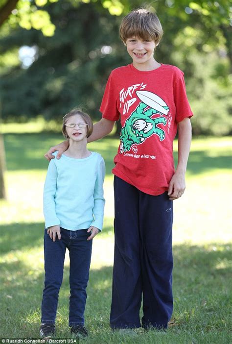 Year Old Ontario Girl With Primordial Dwarfism Weighs The Same As A Two Year Old Daily Mail
