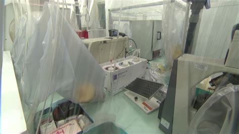 Scotland Confirms Case Of Ebola Cnn